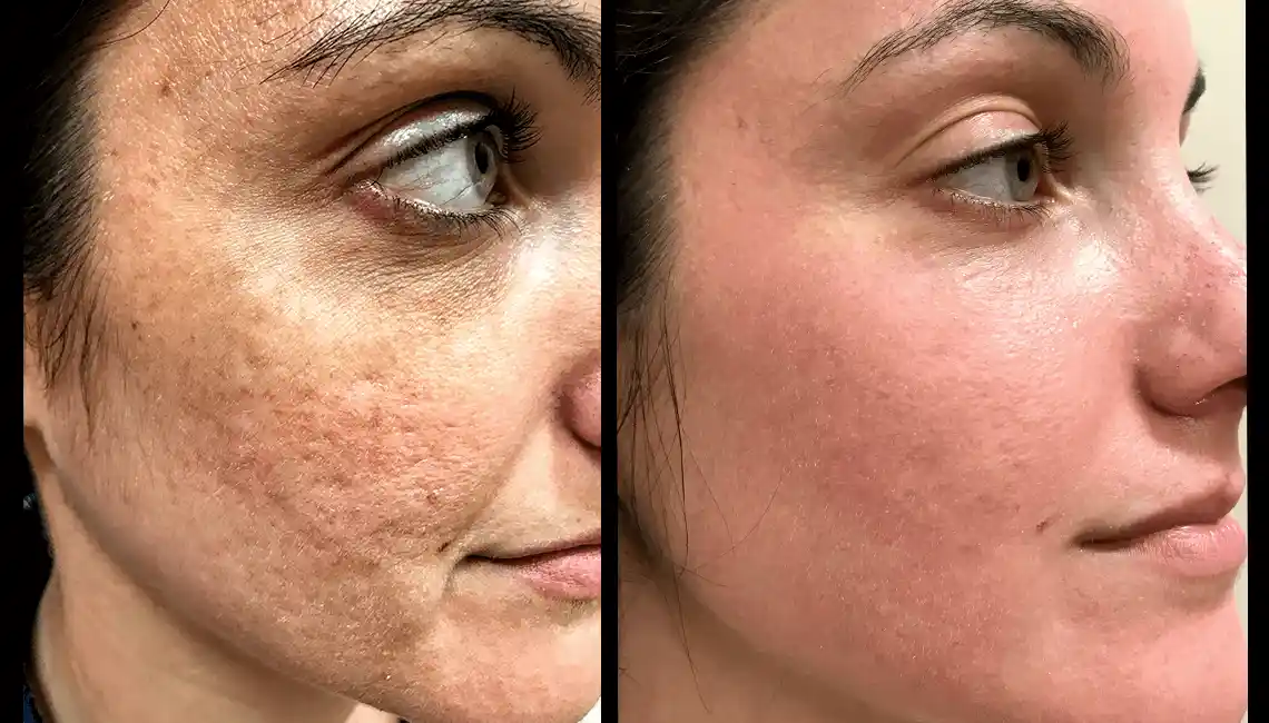 NewYou_HaloBA_Cover-1140x650-1